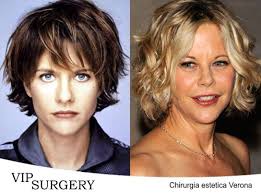 Sfrangiato, colpi di sole a profusione, spettinato per rendere al massimo, . Meg Ryan Naturale O Rifatta Chirurgia Estetica Verona