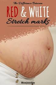 Pin On Pregnancy And Beyond