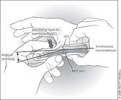 In this video, i discuss how the injury. Skier S Thumb Physiopedia
