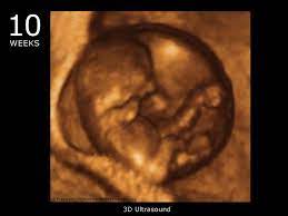 We did not find results for: Pin On Baby Development Week By Week