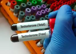 Image result for Total Testosterone