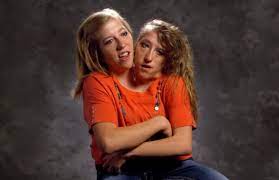 We did not find results for: Abby And Brittany Hensel How Do Conjoined Twins Take Exams Did They Each Have Their Own Grades And Test Scores Knovhov Com
