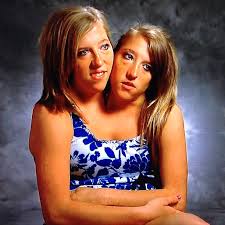 February 8, 2021 may 16, 2020 by dr. Are Conjoined Twins Abby And Brittany Hensel Married In 2021 Tuko Co Ke