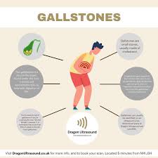Image result for Gallstone