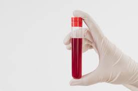 Como o sangue flui por todo o corpo, atuando como meio de obtenção de oxigênio e nutrientes pelos tecidos. Exames De Sangue Quais Sao Os Principais Tipos E Deteccoes Mais Comuns Laboratorio Cortes Villela