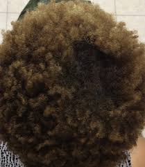 We did not find results for: Central Centrifugal Cicatricial Alopecia Dermatologic Clinics