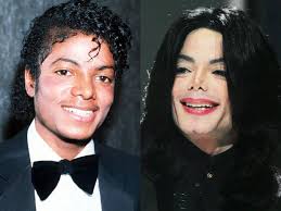 Before surgery, you will meet your anesthesiologist. Michael Jackson Celebrity Plastic Surgery Disasters Cbs News