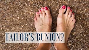 Check spelling or type a new query. Tailors Bunion How We Can Help Da Vinci Foot And Ankle