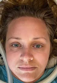 Tingling in the tongue and lips as well as twitching in the lips have  anything to do with sarc? 🤷🏻‍♀️