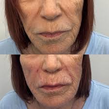 Personalized Aesthetic Care with a Compassionate Nurse Practitioner