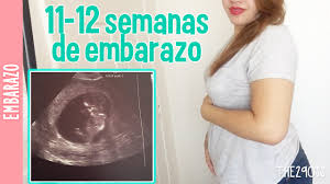 11 12 Semanas De Embarazo Conoce A Mi Bebe Los290ss Youtube