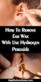 How To Remove Ear Wax With Use Hydrogen Peroxide In 2020 Natural Ear Wax Removal Clean Ear Wax Out Ear Wax