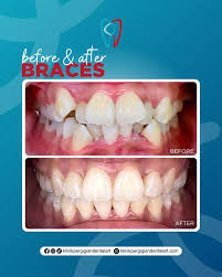 Klinik Pergigian Dentalart, Bukit Katil, Melaka | Expert Braces, Exceptional Results