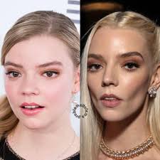 anya taylor-joy then + now ( reminder! my posts are not meant to accuse  anyone of having any cosmetic procedures or insinuate such. i'm just  sharing info so you can all form