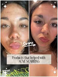 โปรแรงสุด! ซื้อ Cerave รับกล่องจุ่มชินจังฟรี