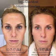 Best night since I started!! Needs to be consistent now….🙏🏻