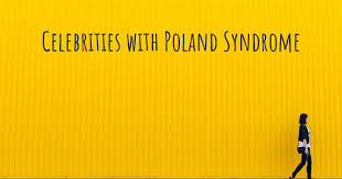 Celebrities With Poland Syndrome