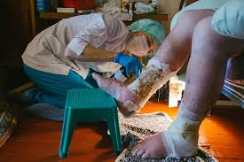 Iz Nog Teklo Tak Chto Ya Podstavlyala Taziki Byvshaya Baletmejster Stavit Na Nogi Bolnogo Starika Imena