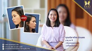 น้องเก๋ เน็ตไอดอลคนใหม่ จากหน้าตาธรรมดา เปลี่ยนให้สวยใสได้ขนาดนี้ อัป. à¸ªà¸–à¸²à¸š à¸™à¸¨ à¸¥à¸¢à¸à¸£à¸£à¸¡à¸•à¸à¹à¸• à¸‡à¸„à¸§à¸²à¸¡à¸‡à¸² Bangkok Hospital Siriroj 44 Chalermprakiat Ror 9 Road Wichit Phuket 2021