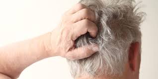 In the second type of seborrhea, the skin is dry, sometimes itchy. Itchy Scalp Causes Treatment Prevention