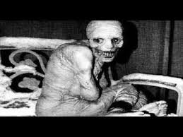 But my question is, does anybody know where the photo usually used for this story is taken from? The Unholy Conspiracy The Russian Sleep Experiment Continued Youtube