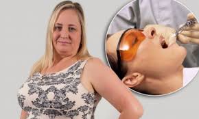 Omfggggg i have to get it out next month and now u made me 100x times scared. Woman S Wisdom Teeth Operation Left Her In Agony For Six Years Daily Mail Online