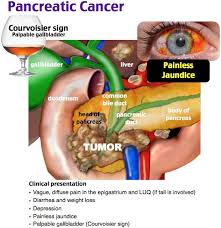 Rosh Review Oncology Nursing Nursing Mnemonics Medical School Motivation