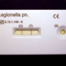 Ihren namen erhielt sie, als 1976 im verlauf eines kongresses der amerikanischen legion 180 der mitglieder an einer bis dahin unbekannten bakterieninfektion erkrankten. Legionellen Doccheck Flexikon