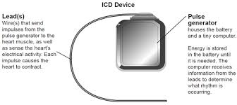 It sends electrical pulses to regulate abnormal heart rhythms, especially those that could be dangerous and cause a cardiac arrest. Implantable Cardioverter Defibrillator Icd Treatment Outlook