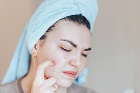 How A Chronic Skin-Picker Created a Sane, Affordable Skin Care Routine —  SkinSpaMED