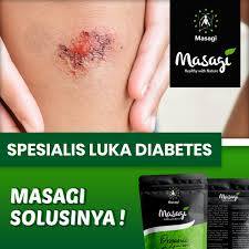 Diabetes adalah penyakit yang boleh dirawat untuk kebanyakan anjing tetapi rawatan untuk anjing yang menghidap diabetes biasanya panjang. Jual Masagi Obat Herbal Diabetes Pengering Luka Diabetes 215 Gram Kab Sidoarjo Masagi Ind Tokopedia