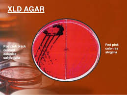 Xylose lysine desoxycholate agar (xld) is a selective medium that is used for the isolation and differentiation of enteric pathogens such as the …shigella and salmonella are colorless and transparent and typically do not alter appearance of the medium. Culture Media And Methods For Mbbs