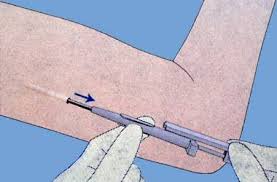 Mit bestimmten verhütungsmitteln können gesundheitliche zusatznutzen verbunden sein, die ein wichtiges entscheidungskriterium darstellen. Empfangnisverhutung Kantonsspital Baden Ksb