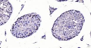 Nonton mortal kombat 2021 sub indo lk21. Cdkn1a Polyclonal Antibody Bioss
