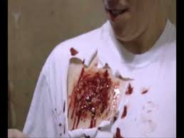 Wounds due to slugs wound ballistics of the shotgun shotgun wounds. Lee Andrew S Gorification Shotgun Wound To The Chest Youtube