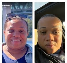 Visible weight loss progress in face
