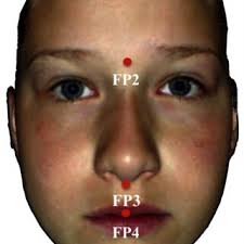 Three-dimensional facial surface reconstruction showing the landmarks...