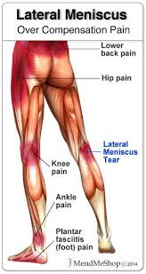 Pin On Knees Knee Exercises Knee Injuries Knee Treatment