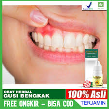 We did not find results for: Obat Gusi Bengkak Ngilu Sakit Gigi Obat Infeksi Radang Gusi Berdarah Herbal Propolis Sm Alami Shopee Indonesia