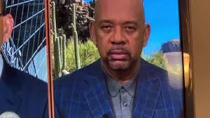 Mike Wilbon Black Eye