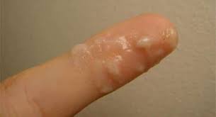 Maybe you would like to learn more about one of these? Cervical Mucus Before After During Period
