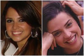 Check spelling or type a new query. Bbb18 Internautas Fazem Antes E Depois De Paula E Supoem Plastica