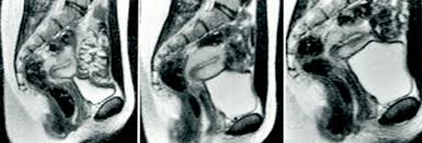 Wild MRI scan shows what happens to our bodies during sex