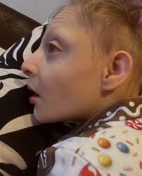 Simone Braunsdorf-Kremer (@jonathan_ein_leben_mit_mopd1) • Instagram photos  and videos