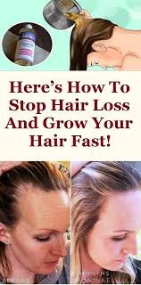 Here S How To Stop Hair Loss And Grow Your Hair Fast How To Grow Your Hair Faster Stop Hair Loss Hair Loss Remedies