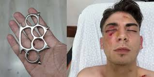 Konya'da kör eden muştalı saldırıda yeni gelişme! Tekrar gözaltına alındılar