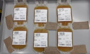 Image result for Plasma Transfusion