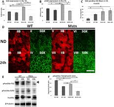 Where do rats hide during the day? Plos One Symmorphosis Through Dietary Regulation A Combinatorial Role For Proteolysis Autophagy And Protein Synthesis In Normalising Muscle Metabolism And Function Of Hypertrophic Mice After Acute Starvation