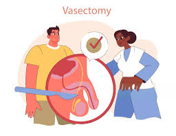 Image result for Vasectomy