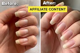 The cuticle is a thin layer of dead tissue riding on the nail plate to form a seal between the nail plate and eponychium to prevent pathogens from infecting the matrix area. I Put The Highly Rated Cuticle Remover That Thousands Of People Have Reviewed On Amazon To The Test Here S What Happened